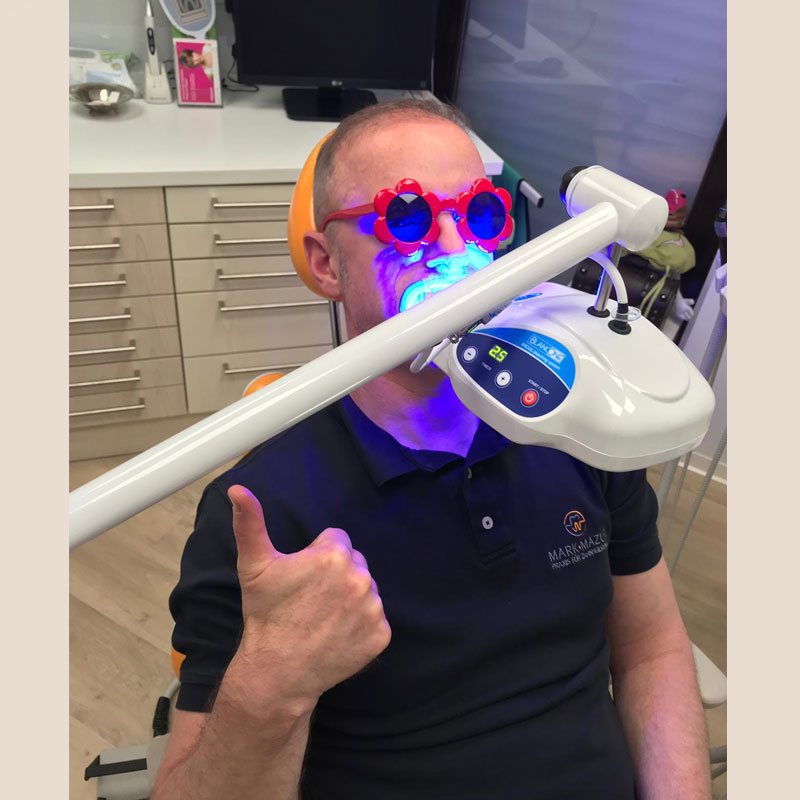 Strahlend weiße Zähne gewünscht